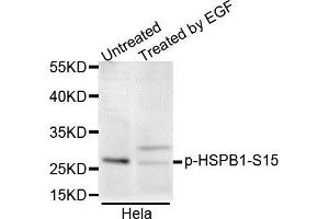 Western blot analysis of extracts of various cell lines, using Phospho-HSPB1-S15 antibody. (HSP27 Antikörper  (pSer15))
