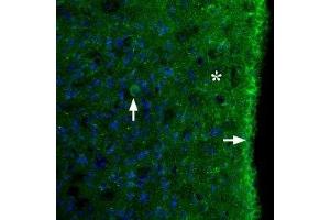 Expression of MC3R in rat brainImmunohistochemical staining of perfusion-fixed frozen rat brain sections using Anti-MC3 Receptor (extracellular) Antibody (ABIN7043323 and ABIN7044595), (1:100). (Melanocortin 3 Receptor (MC3R) Peptid)