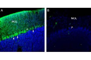 Expression of TRPM3 in mouse cerebellum.