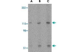 Western blot analysis of PRSS12 in SK-N-SH cell lysate with PRSS12 polyclonal antibody  at (A) 0. (Neurotrypsin Antikörper  (N-Term))