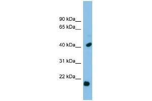 HSPB2 antibody used at 1 ug/ml to detect target protein. (HSPB2 Antikörper  (Middle Region))