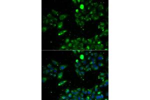 Immunofluorescence analysis of U2OS cell using UQCRFS1 antibody. (UQCRFS1 Antikörper)