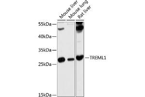 Western blot analysis of extracts of various cell lines, using TREML1 antibody (ABIN6129498, ABIN6149484, ABIN6149485 and ABIN6214659) at 1:1000 dilution. (TREML1 Antikörper  (AA 16-162))