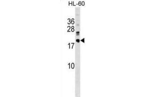 Western Blotting (WB) image for anti-DnaJ (Hsp40) Homolog, Subfamily C, Member 30 (DNAJC30) antibody (ABIN5019514) (DNAJC30 Antikörper)