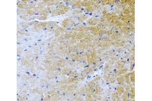 Immunohistochemistry of paraffin-embedded Mouse heart using BMP3 Polyclonal Antibody at dilution of 1:100 (40x lens). (BMP3 Antikörper)