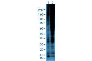 Western blot analysis of Lane 1: serum-starved A431 cells, Lane 2: serum-starved A431 cells treated with Calyculin A/Okadaic Acid using Phosphothreonine monoclonal antibody, clone RM102  at 1:2000 dilution. (Phosphothreonine Antikörper)