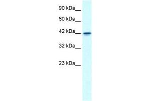 WB Suggested Anti-GFI1B Antibody Titration: 0. (GFI1B Antikörper  (N-Term))