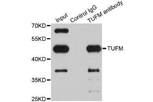 Immunoprecipitation analysis of 200ug extracts of Jurkat cells using 1ug TUFM antibody. (TUFM Antikörper  (AA 186-455))