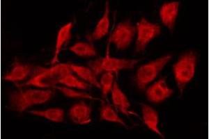ABIN6267352 staining MCF7 by IF/ICC. (Bcl-2 Antikörper  (pSer70))