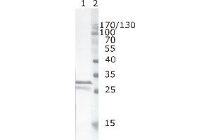 Western Blot testing of HIV-1 recombinant Nef protein. (HIV-1 Nef (AA 35-50) Antikörper)