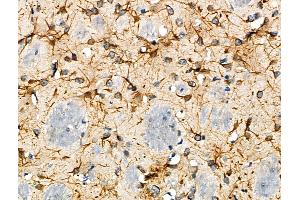ABIN6263536 and ABIN6277080 at 1/100 staining Mouse brain tissue by IHC-P. (NCF4 Antikörper  (C-Term))