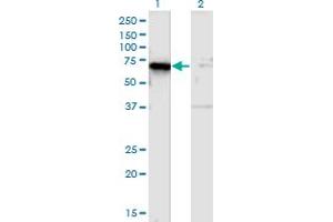 Western Blot analysis of TSPYL1 expression in transfected 293T cell line by TSPYL1 monoclonal antibody (M01), clone 4F11.