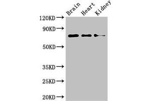 Western Blot Positive WB detected in: Mouse brain tissue, Mouse heart tissue, Mouse kidney tissue All lanes: PDIA4 antibody at 4 μg/mL Secondary Goat polyclonal to rabbit IgG at 1/50000 dilution Predicted band size: 73 kDa Observed band size: 73 kDa (PDIA4 Antikörper  (AA 101-400))