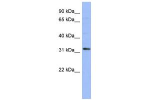 WB Suggested Anti-TLX1 Antibody Titration:  0.