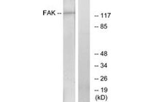 Western blot analysis of extracts from HeLa cells, treated with Serum, using FAK (Ab-861) Antibody. (FAK Antikörper  (AA 828-877))