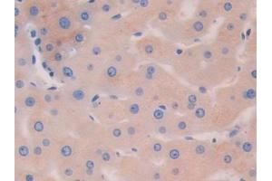 Detection of HEXb in Human Liver Tissue using Polyclonal Antibody to Hexosaminidase B Beta (HEXb)