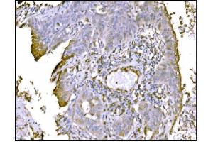 IHC analysis of TRAP Alpha/TRAPA/SSR1 using anti-TRAP Alpha/TRAPA/SSR1 antibody (ABIN7601975).