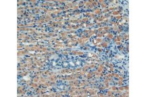 IHC-P analysis of stomach tissue, with DAB staining. (SERPING1 Antikörper  (AA 148-270))