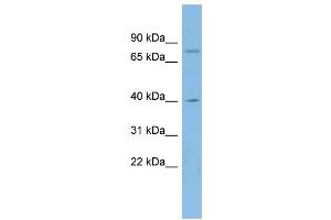 WB Suggested Anti-CUX1 Antibody Titration:  0. (CUX1 Antikörper  (N-Term))