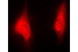 Immunofluorescence (IF) image for anti-Proteasome (Prosome, Macropain) Subunit, beta Type, 5 (PSMB5) antibody (ABIN7306068)