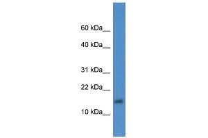 WB Suggested Anti-XAGE2 Antibody Titration: 0. (XAGE2 Antikörper  (Middle Region))