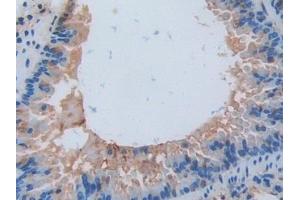 Detection of IL17RA in Mouse Lung Tissue using Polyclonal Antibody to Interleukin 17 Receptor A (IL17RA)