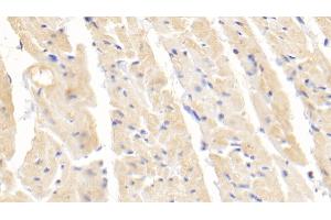 Detection of SOD1 in Rabbit Cardiac Muscle Tissue using Polyclonal Antibody to Superoxide Dismutase 1 (SOD1) (SOD1 Antikörper  (AA 2-153))