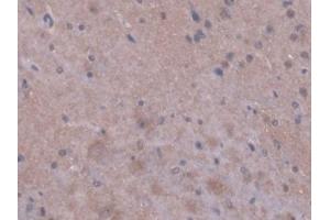 Detection of PPIF in Mouse Cerebrum Tissue using Polyclonal Antibody to Peptidylprolyl Isomerase F (PPIF) (PPIF Antikörper  (AA 44-192))
