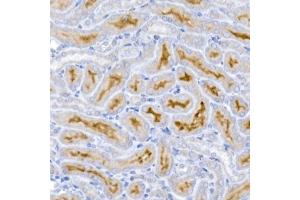 Immunohistochemistry of paraffin-embedded mouse kidney using Caspase-9 Rabbit mAb (ABIN6135366, ABIN7101390, ABIN7101391 and ABIN7101392) at dilution of 1:400 (40x lens).
