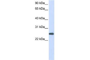 WB Suggested Anti-PRDX1 Antibody Titration:  0. (Peroxiredoxin 1 Antikörper  (N-Term))