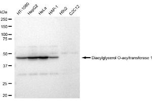 Western blotting analysis using Diacylglycerol O-acyltransferase 1 antibody (ABIN7798329). (Rekombinanter DGAT1 Antikörper)