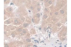 Detection of Nesp2 in Human Liver Tissue using Polyclonal Antibody to Nesprin 2 (Nesp2) (SYNE2 Antikörper  (AA 6-296))