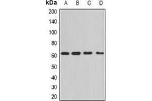 Western blot analysis of PPP3CA expression in Hela (A), A549 (B), mouse brain (C), mouse lung (D) whole cell lysates.