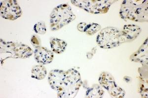 IHC analysis of CCNE1 using anti-CCNE1 antibody (ABIN7601193). (Cyclin E1 Antikörper  (AA 3-386))