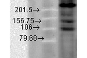 Western Blot analysis of Hamster T-CHO cell lysate showing detection of CaV1. (CACNA1C Antikörper  (AA 1507-1733) (Atto 390))