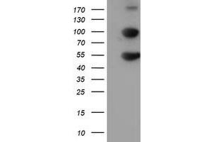 Western Blotting (WB) image for anti-Histidyl-tRNA Synthetase 2, Mitochondrial (Putative) (HARS2) antibody (ABIN1498583) (HARS2 Antikörper)