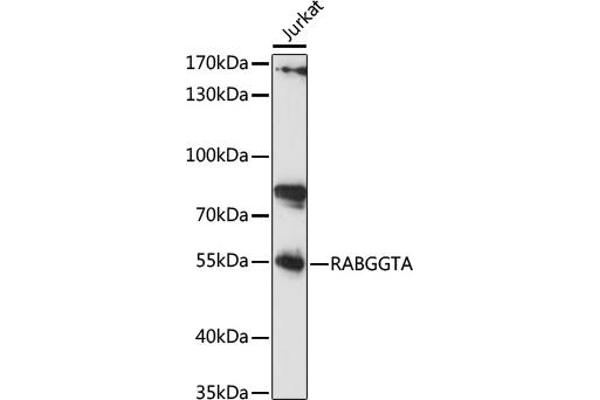RABGGTA Antikörper  (AA 240-360)