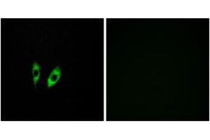Immunofluorescence analysis of HeLa cells, using GPR156 Antibody.