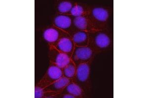 IF analysis of gamma Catenin using anti-gamma Catenin antibody (ABIN7602031).