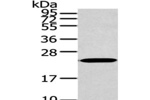 Western Blot analysis of 293T cells using ARL2 Polyclonal Antibody at dilution of 1/200 (ARL2 Antikörper)