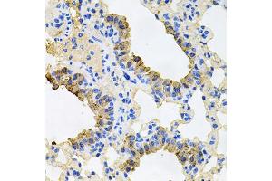 Immunohistochemistry of paraffin-embedded mouse lung using IGF1R antibody (ABIN5970073) at dilution of 1/100 (40x lens). (IGF1R Antikörper  (N-Term))