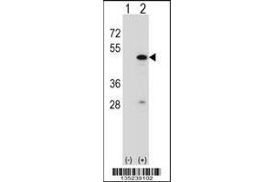 Western blot analysis of RBM22 using rabbit polyclonal RBM22 Antibody using 293 cell lysates (2 ug/lane) either nontransfected (Lane 1) or transiently transfected (Lane 2) with the RBM22 gene. (RBM22 Antikörper  (AA 165-193))