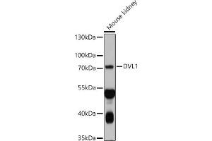 Western blot analysis of extracts of Mouse kidney, using DVL1 antibody (ABIN7266796) at 1:1000 dilution. (DVL1 Antikörper  (AA 510-640))