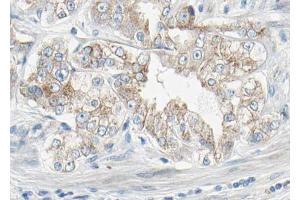 AF3132 at 1/100 staining human Prostate tissue sections by IHC-P. (PDGFRB Antikörper  (pTyr1021))