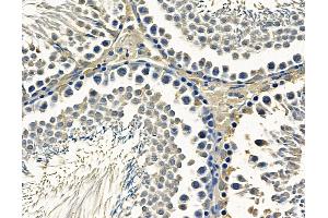 ABIN7096773 and ABIN7100839 at 1/100 staining rat testis tissue by IHC-P.