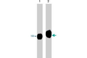 Western blot analysis of PLCG1 immunoprecipitates from human Jurkat cells untreated (lane 1) or treated with pervanadate (1 mM) for 30 min (lane 2).