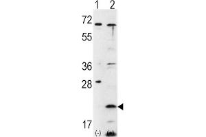 Western Blotting (WB) image for anti-Frataxin (FXN) antibody (ABIN3002642) (Frataxin Antikörper)