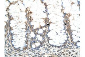 CHIC2 antibody was used for immunohistochemistry at a concentration of 4-8 ug/ml. (CHIC2 Antikörper  (N-Term))