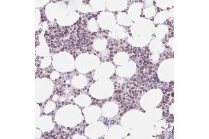 Immunohistochemical staining (Formalin-fixed paraffin-embedded sections) of human bone marrow with VPREB1 polyclonal antibody  shows moderate nuclear membrane positivity in hematopoietic cells. (VPREB1 Antikörper  (AA 20-138))
