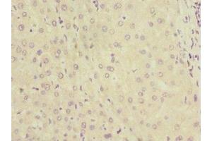 Immunohistochemistry of paraffin-embedded human liver tissue using ABIN7157750 at dilution of 1:100 (KYNU Antikörper  (AA 1-307))